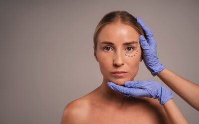 ¿Qué tratamientos de medicina estética se pueden hacer en verano?