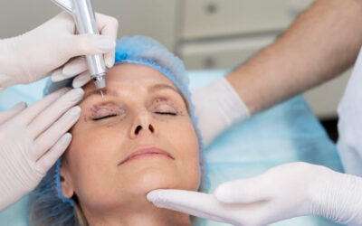 5 Mitos sobre el lifting facial