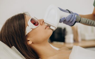 Luz pulsada intensa (IPL): preguntas frecuentes antes de comenzar el tratamiento