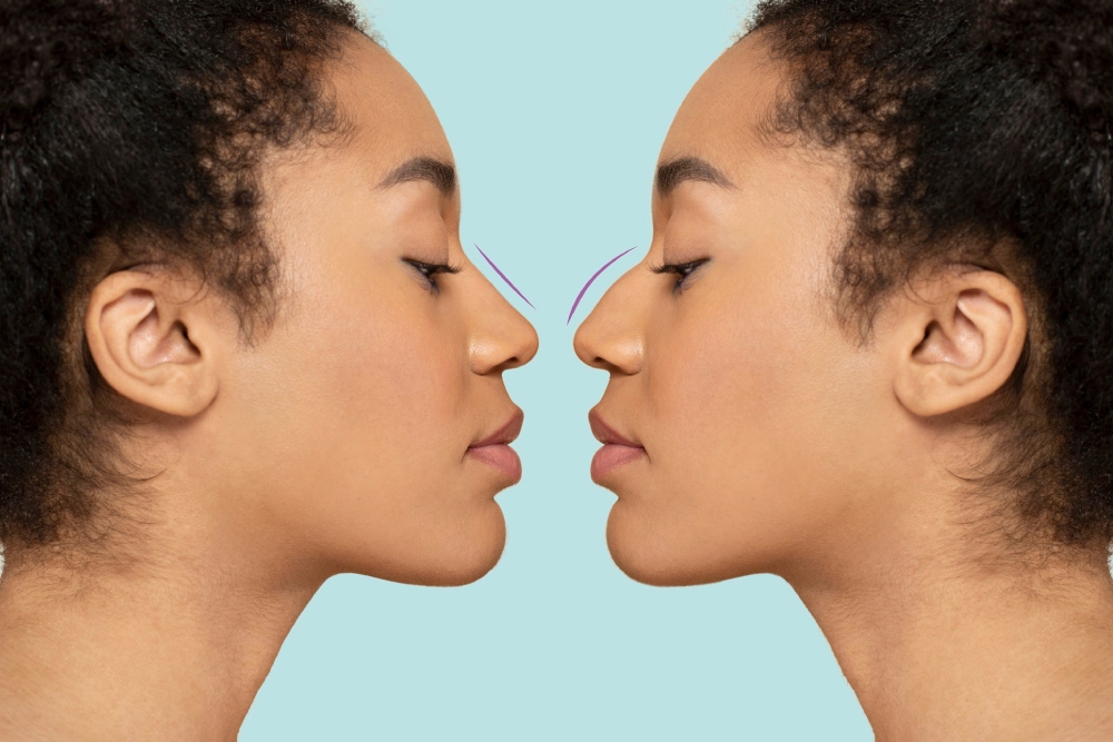mujer con nariz diferente mujer con nariz diferente