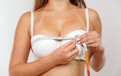 Reducción de pecho y deporte: cuándo volver a entrenar y con qué cuidados