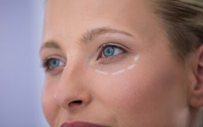 Tipos de blefaroplastia: superior, inferior y completa