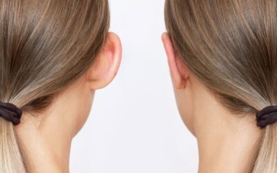 Otoplastia infantil vs adulta: diferencias en técnica y recuperación