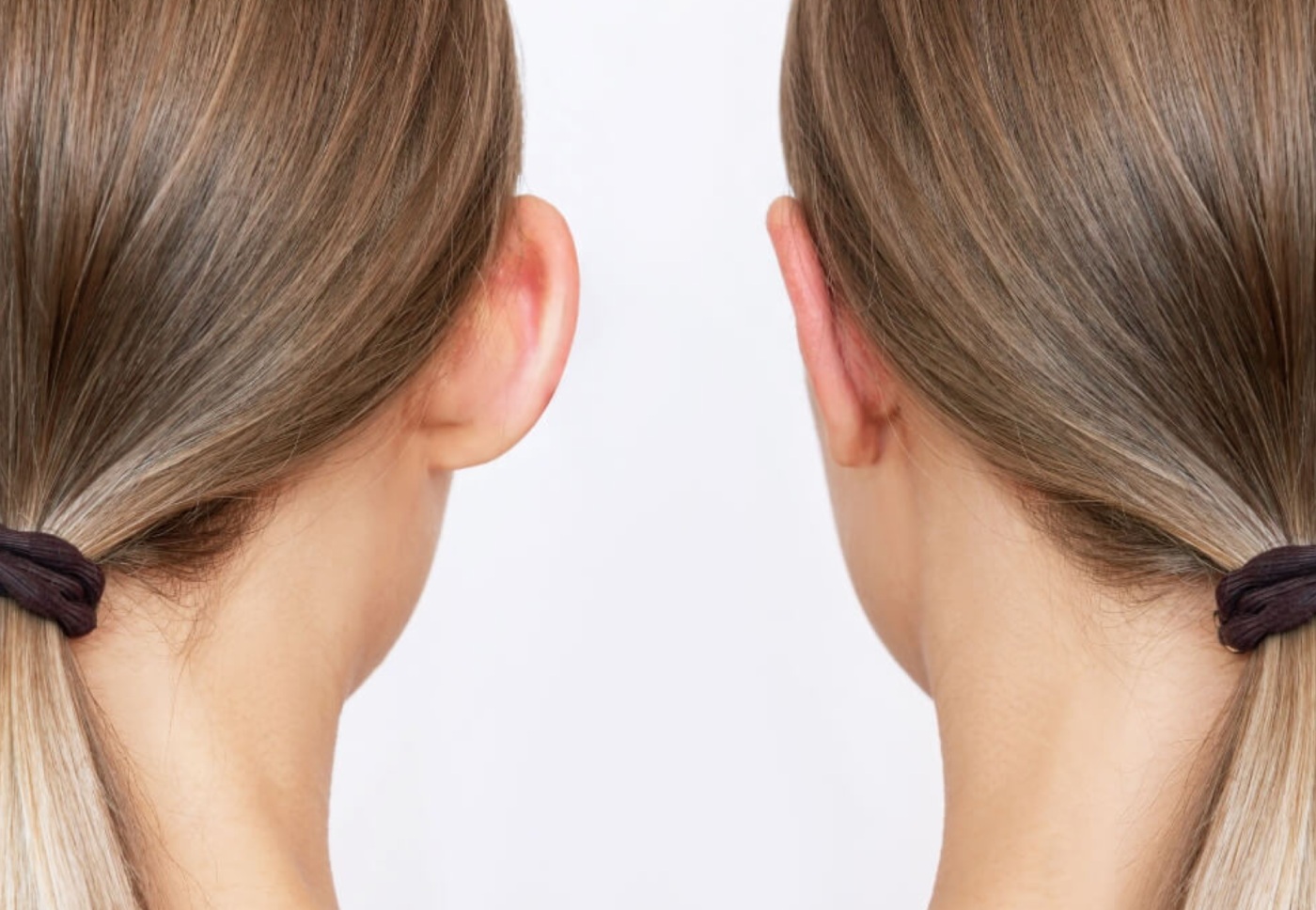 chica de espaldas orejas separadas juntas