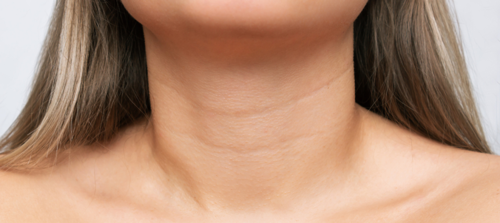 cuello-mujer-estirado